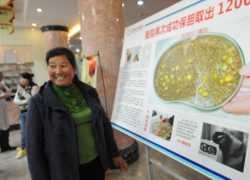 我院再次成功保胆取出12000