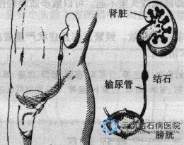56_111207172501_1.jpg