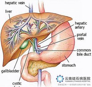 慢性胆囊炎是如何引起的_胆囊结石常识_云南