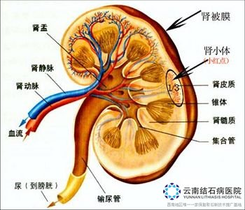 <em>得了肾</em>积水<em>怎么办</em> 如何治疗_<em>肾结石</em>治疗_云南