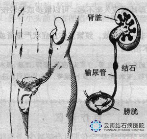 70-12051914225O02.jpg
