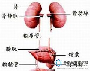 <em>肾结石</em>的主要<em>症状有什么</em>_<em>肾结石症状</em>_云南结