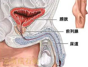 男性疾病咨询