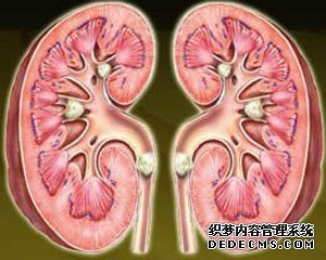 <em>肾结石早期症状</em>有哪些呢_<em>肾结石</em>症状_云南结