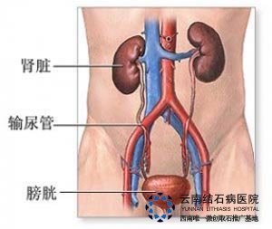 69-120I0111423U2.jpg