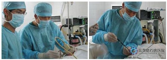 经皮肾镜治疗肾结石