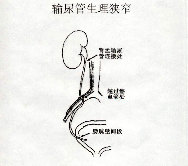 96-1412261H335649.jpg