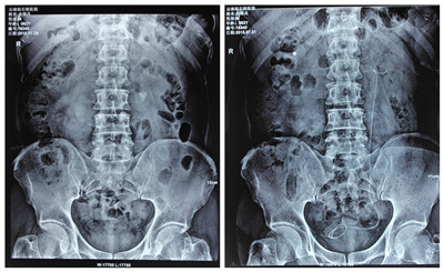 108-150PQ5043D06.jpg